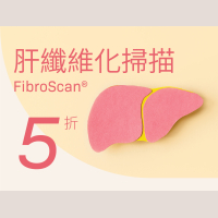 肝纖維化掃描5折優惠