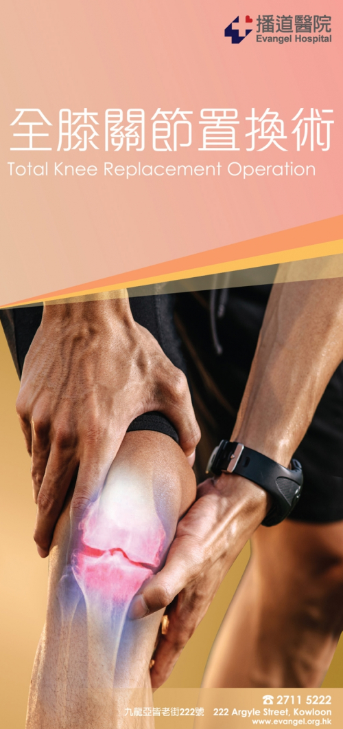 全膝關節置換術